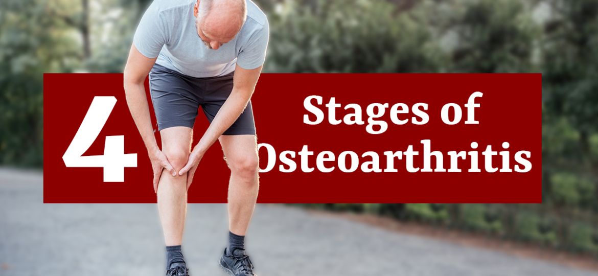 Featured-Image-Stages-of-Osteoarthritis