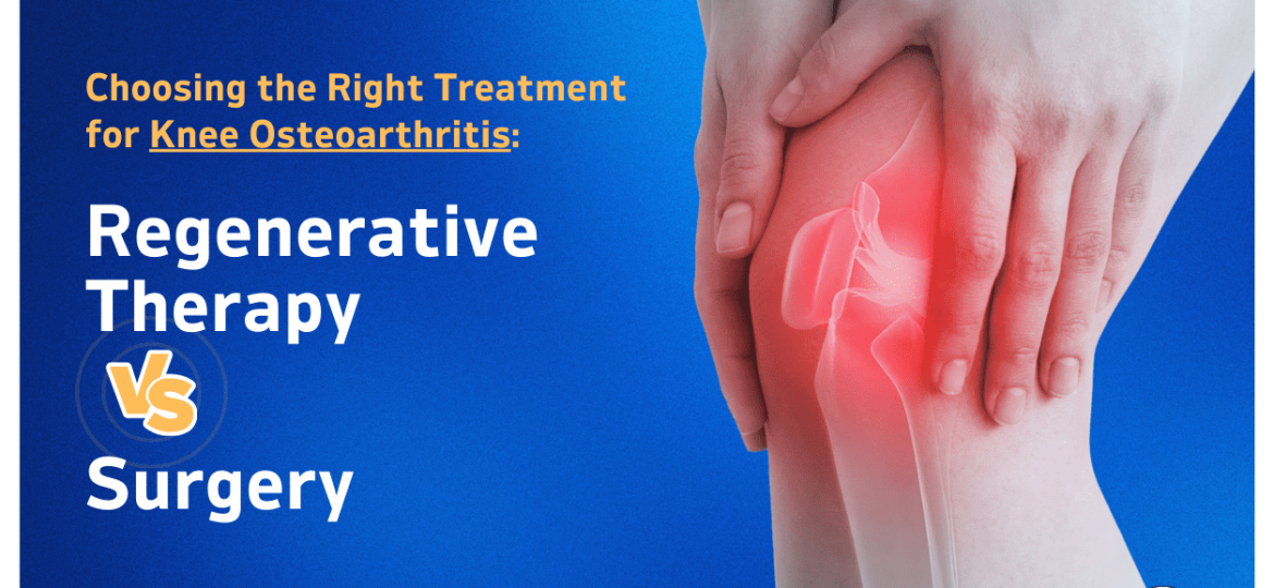 Featured Image - Choosing the Right Treatment for Knee Osteoarthritis Regenerative Therapy vs. Surgery
