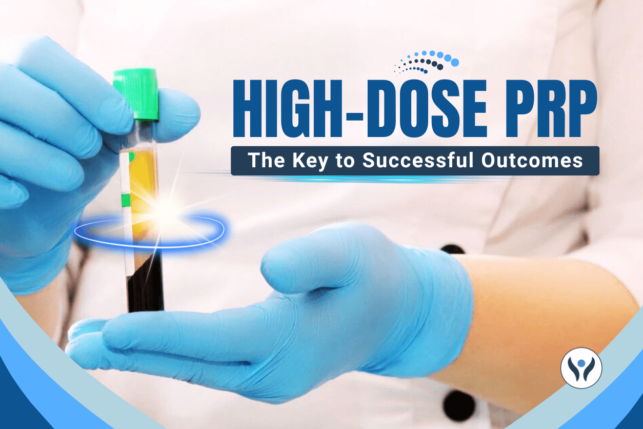 High-Dose PRP: The Key to Successful Outcomes